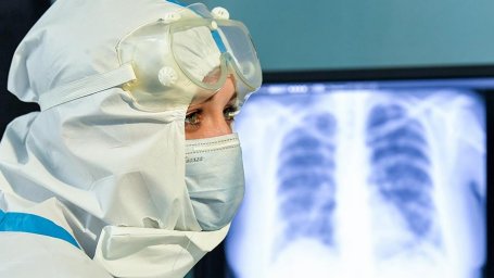 В Краснодарском крае за сутки зафиксировано 99 случаев коронавируса